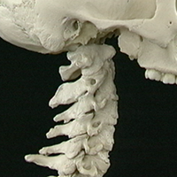 Unraveling the Mystery of Cervical Pain
